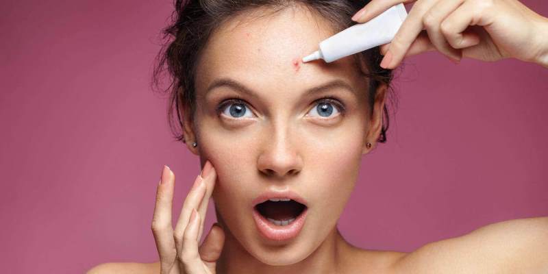 Cara Efektif Menghilangkan Bekas Jerawat: 8 Perawatan Terbaik dan Pengobatan Rumahan